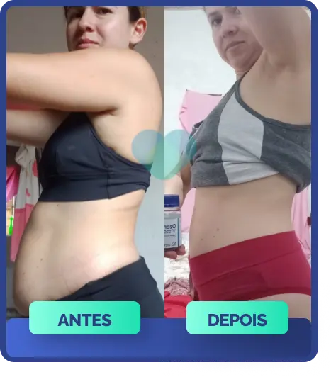 antesedepois-03-5.webp